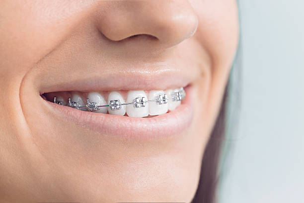 Best Dental Fillings (Composite and Amalgam)  in Holden, MO